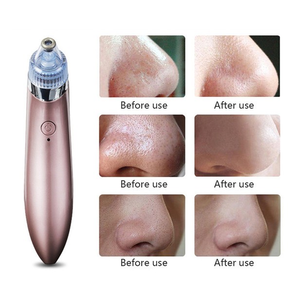 Вакуумный аппарат для чистки пор  Beauty Skin Care Specialist XN-8030 Лучшая цена!